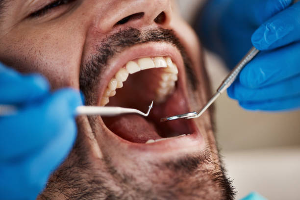 Best Emergency Denture Repair in Mansura, LA