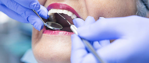 Best Same-Day Emergency Dental Services in Mansura, LA